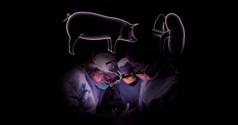 Terbaru, Peneliti AS Berhasil Melakukan Transplantasi Ginjal Babi ke Manusia